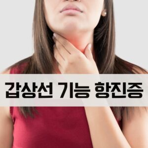 갑상선기능항진증 증상